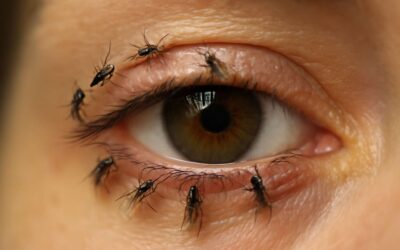 Uncover the startling truth behind why flies on eyes can be a sign of deeper health issues