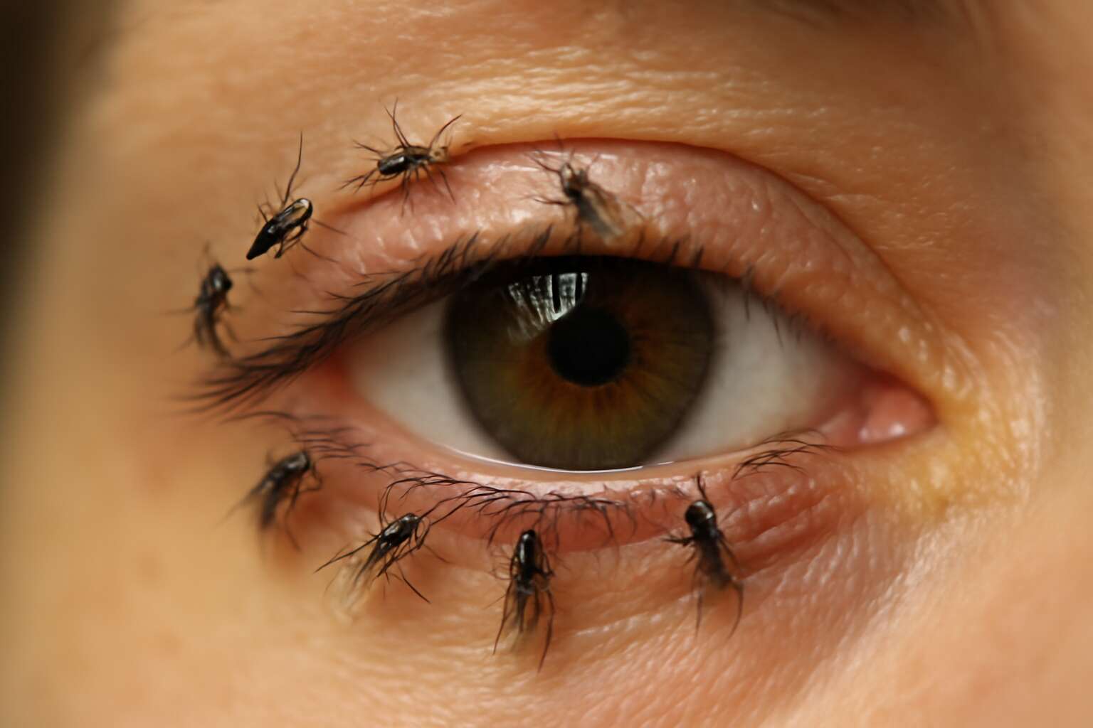 generated_image_688f5a33ca7dc.jpg flies on eyes